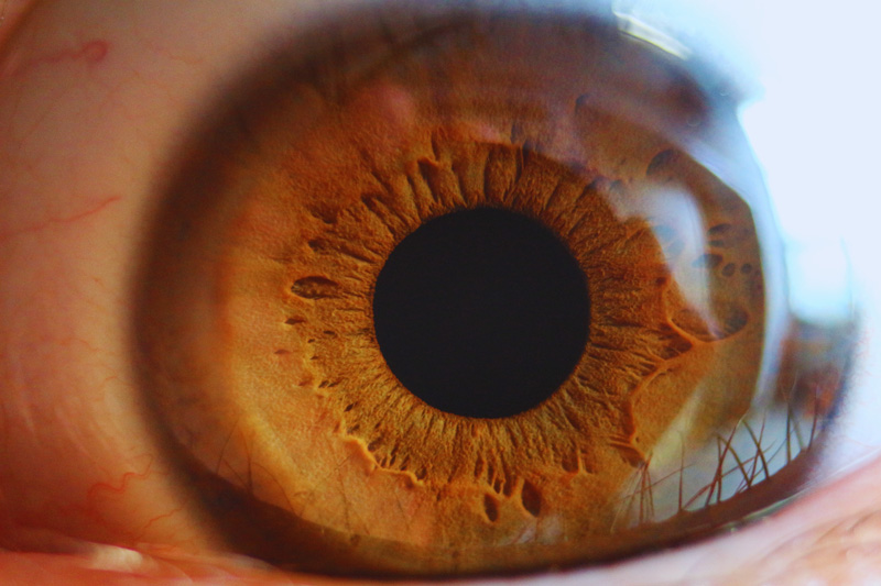 Tailoring Irises
